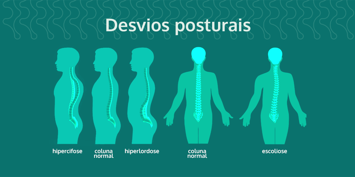 Reeducação Postural Global e a prevenção de alterações posturais